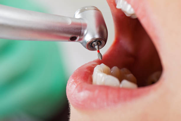 Best Emergency Dental Care for Trauma or Injury in Monument Hills, CA